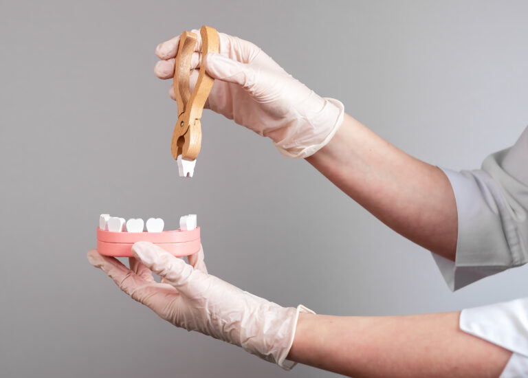 Estrazioni dentali Barletta Andria Trani