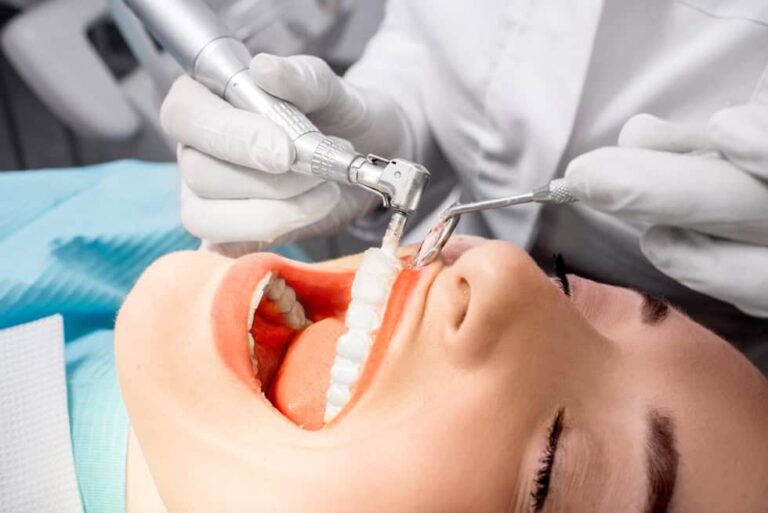 Igiene dentale professionale
