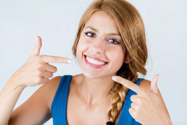 Mantenere i denti bianchi dopo lo sbiancamento