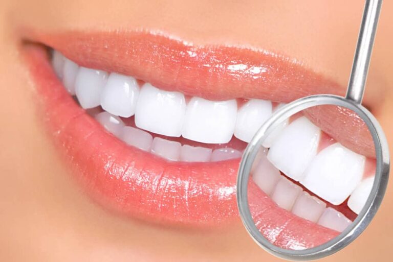 Come l’odontoiatria estetica può migliorare il tuo sorriso