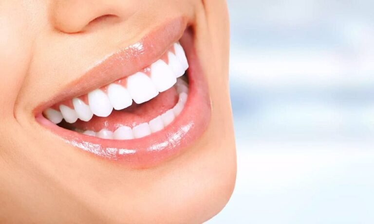 Sbiancamento dei denti professionale