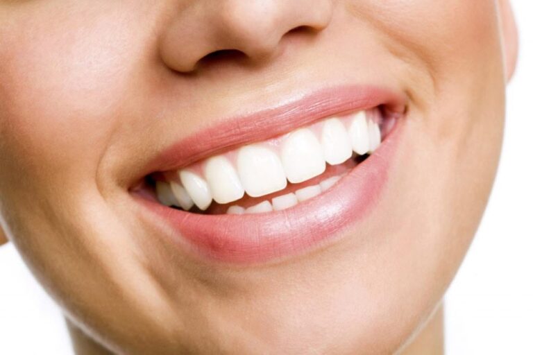 sbiancamento-dei-denti-necessario