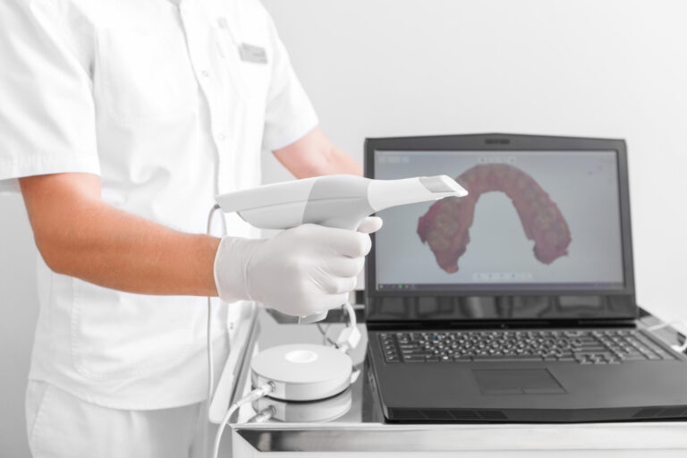 Vantaggi dello scanner 3D in odontoiatria