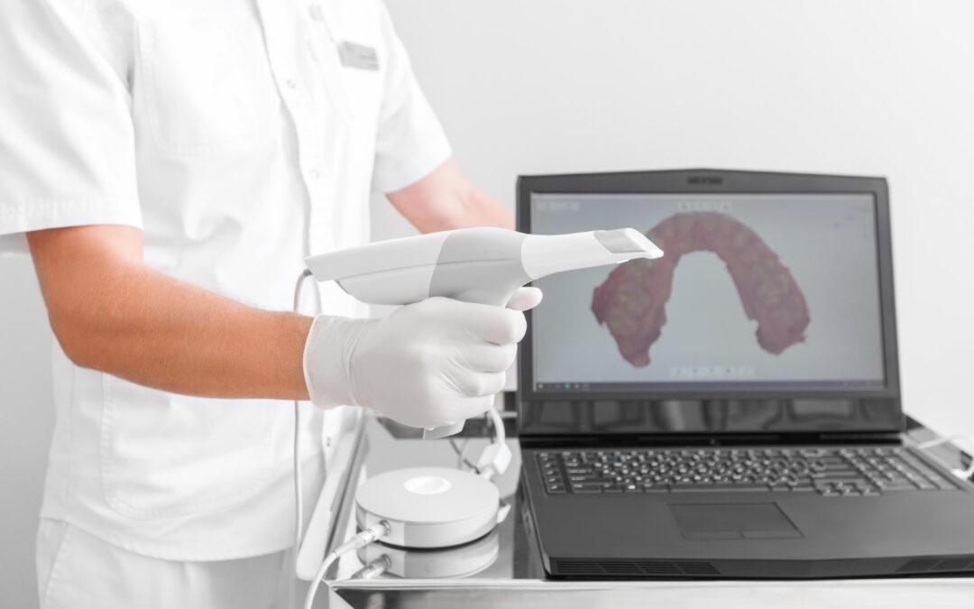 Vantaggi dello scanner 3D in odontoiatria
