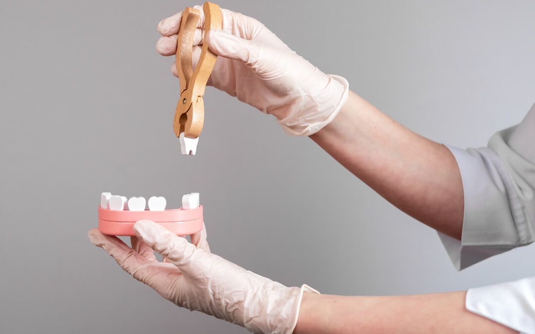 Estrazioni dentali Barletta Andria Trani