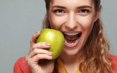 Quali cibi non mangiare con l’apparecchio ai denti?