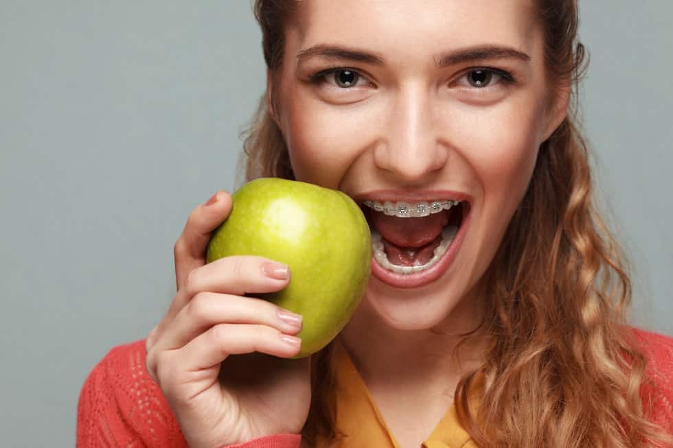 Quali cibi non mangiare con l’apparecchio?
