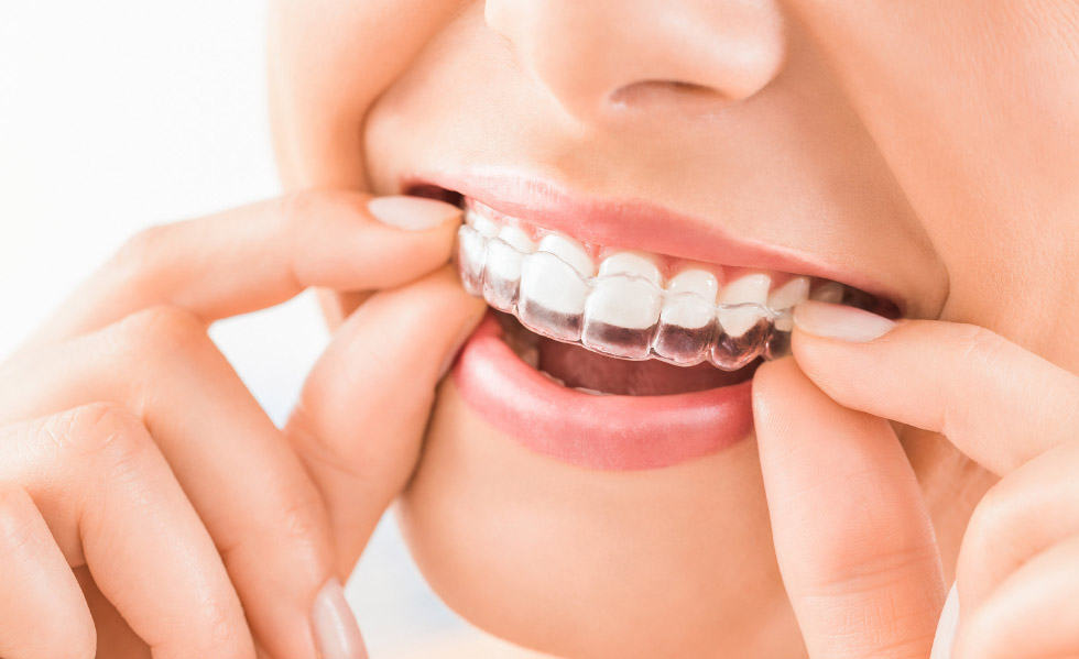 Come trovare il tuo dentista di famiglia