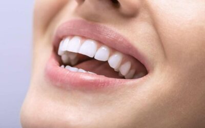 Sbiancamento dei denti: è adatto a te?