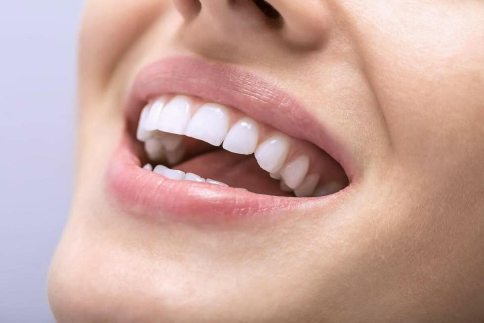 Sbiancamento dei denti