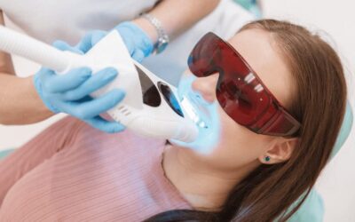 Click illuminante o gel sbiancante: quale scegliere?