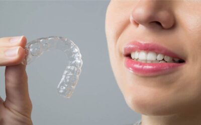 L’apparecchio Invisalign funziona anche da adulti?