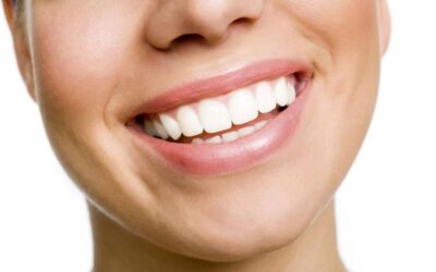Quanto dura lo sbiancamento dei denti?